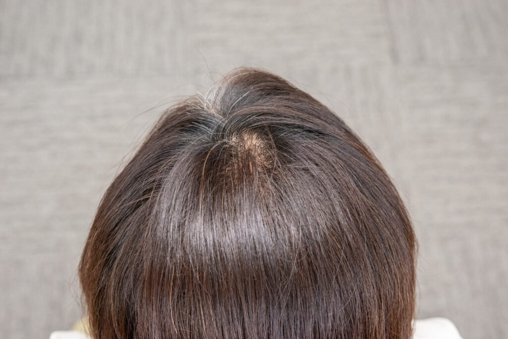 口コミとビフォーアフターのざっくり結論